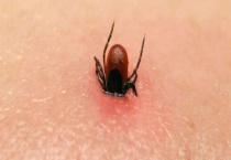 如何鉴别被蜱虫咬了 被蜱虫叮咬了怎么办？