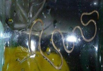 铁线虫怎么杀死 铁线虫会寄生在人体吗？