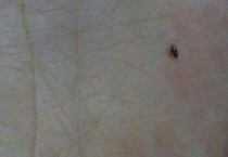 床上可以放什么驱跳蚤