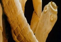 猪肉绦虫能高温杀死吗？附感染方式和危害