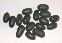 双肾子树长什么样