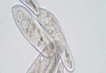 草履虫种类有哪些 不同种类形态各异