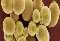 酵母菌的繁殖方式 分别介绍芽殖、裂殖、芽裂、孢子繁殖