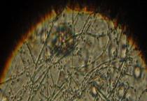 酵母菌是真菌吗 怎么繁殖