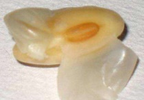 双子叶植物种子结构