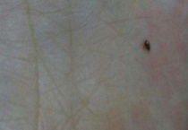 跳蚤的本领是什么？