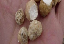 水半夏和旱半夏的区别？ 附其功效和作用