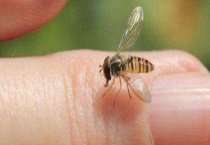 被蜜蜂蛰了找不到刺怎么办 被蜜蜂蛰了怎么多久？